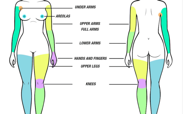 Laser Treatment Areas on Limbs