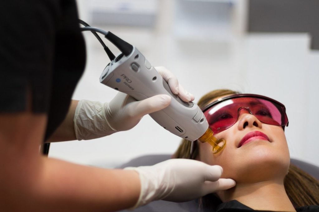 Face Laser Hair Removal