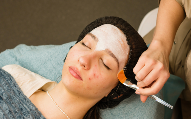 Facial for lady with pimples