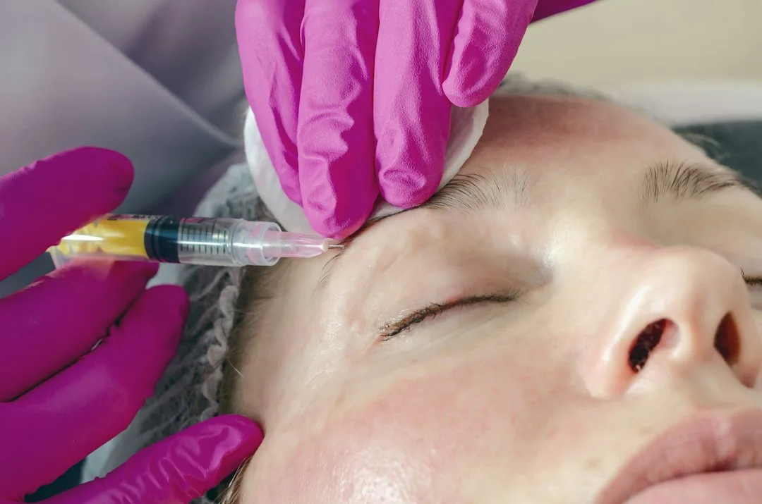 full face botox